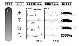 比較21 解説 Ems腹筋ベルト31点の性能とおすすめ 選び方 1 家電批評モノマニア